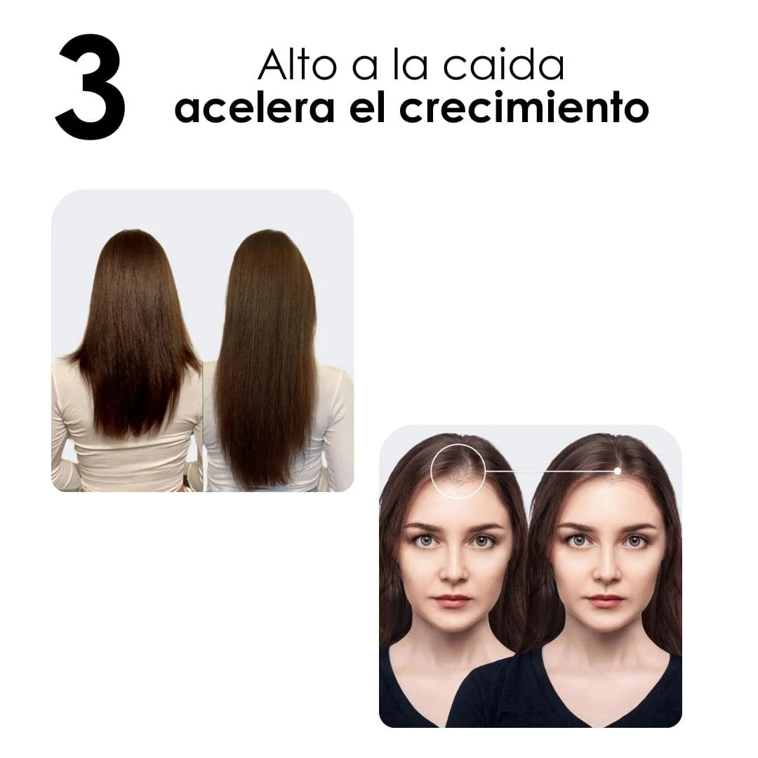 OFERTA ESPECIAL Kit Tratamiento Reparación Total Cabello - Image 5