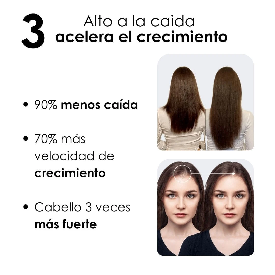 Kit Crecimiento + Anticaída + Reparación + Protección - Image 6