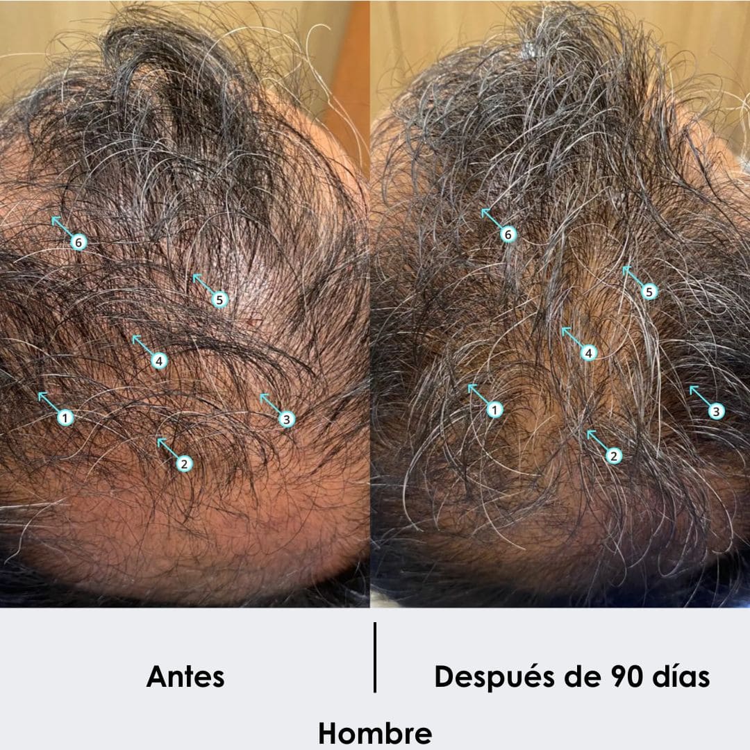 Tratamiento Anticaida + Crecimiento de Cabello Shampoo 250 ML - Image 6