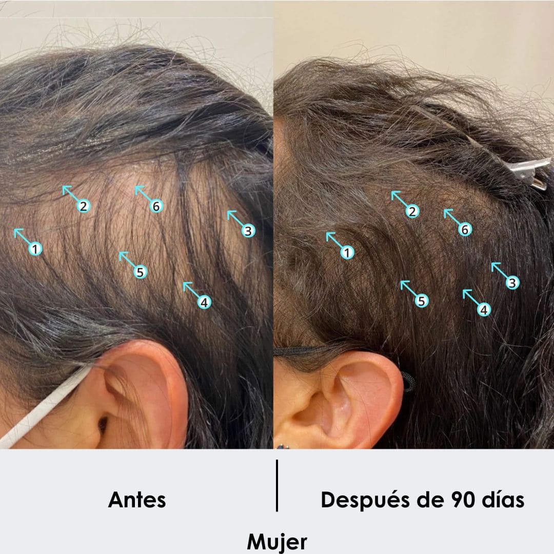 Tratamiento Anticaida + Crecimiento de Cabello Shampoo 250 ML - Image 7